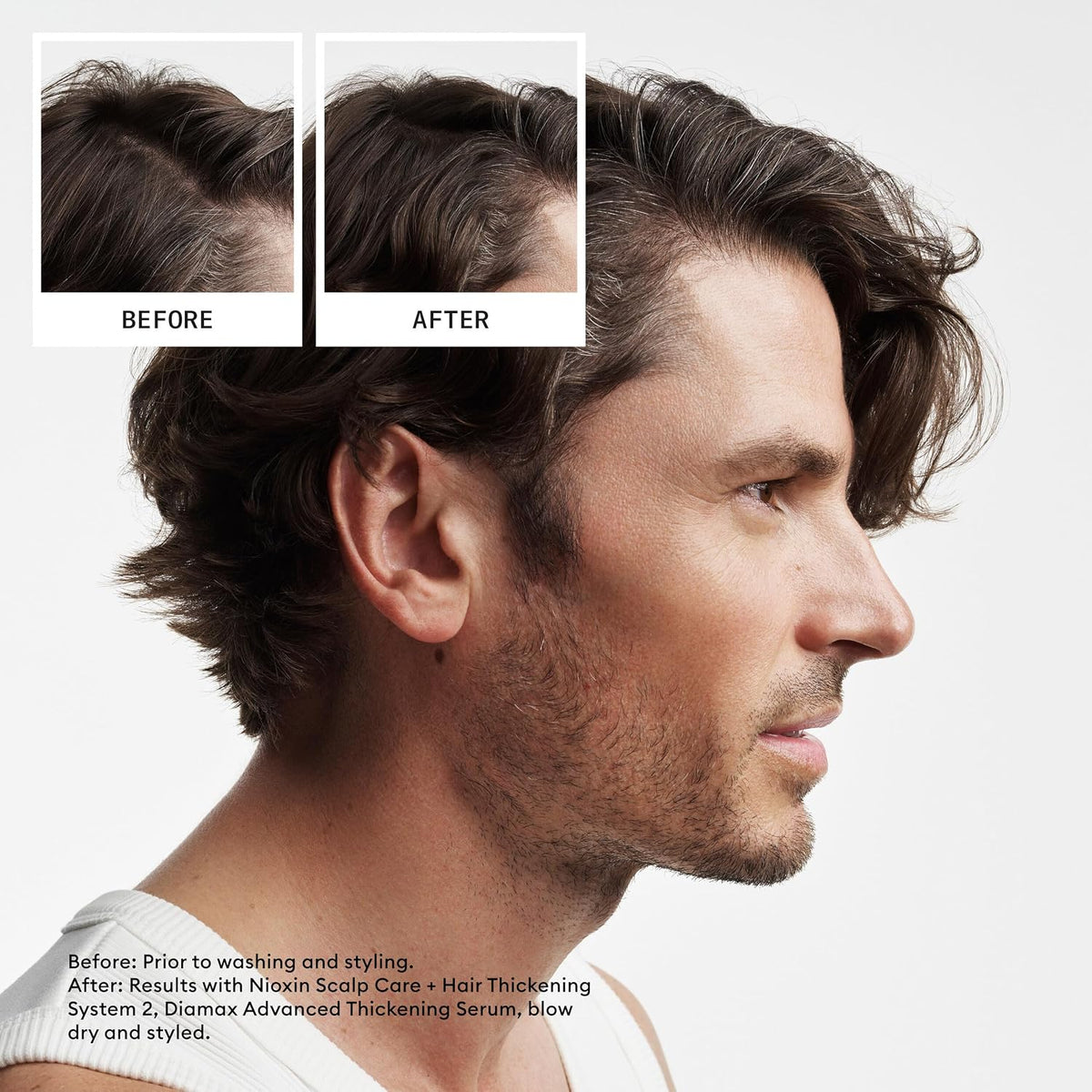 NIOXIN System 2 | Scalp Care | Shampoo | Hair Thickening | For Natural Hair