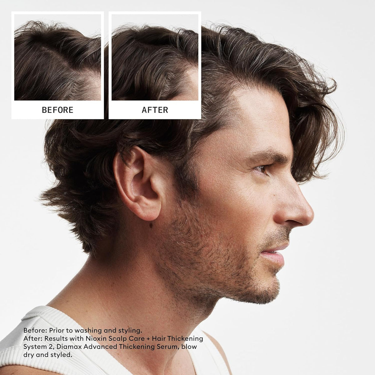 NIOXIN System 2 | Scalp Care | Shampoo | Hair Thickening | For Natural Hair